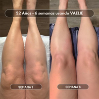 Vaelie Aceite Corporal Anti-Celulitis™